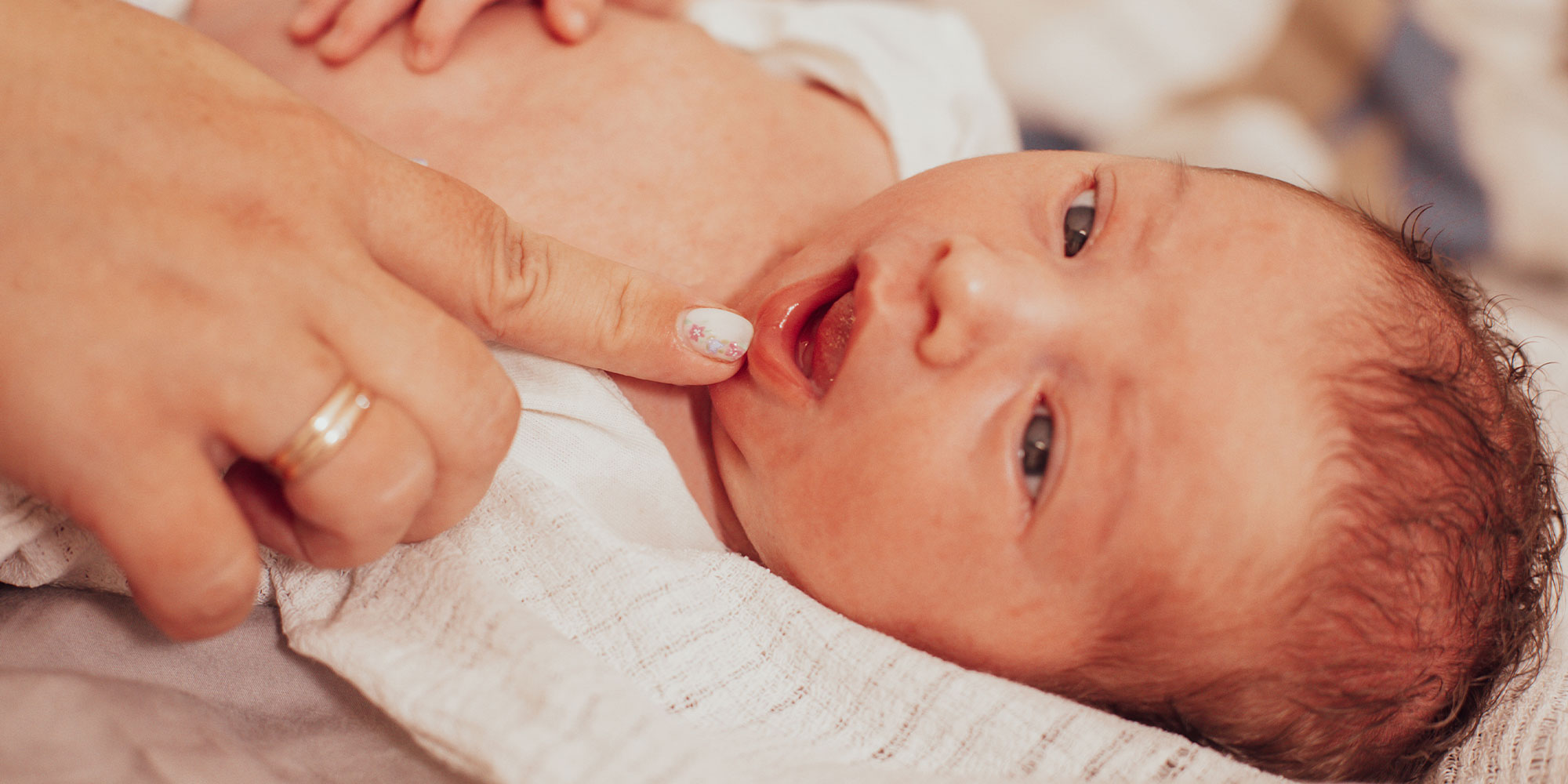 The examination of newborn baby mouth, frenulum of the tongue