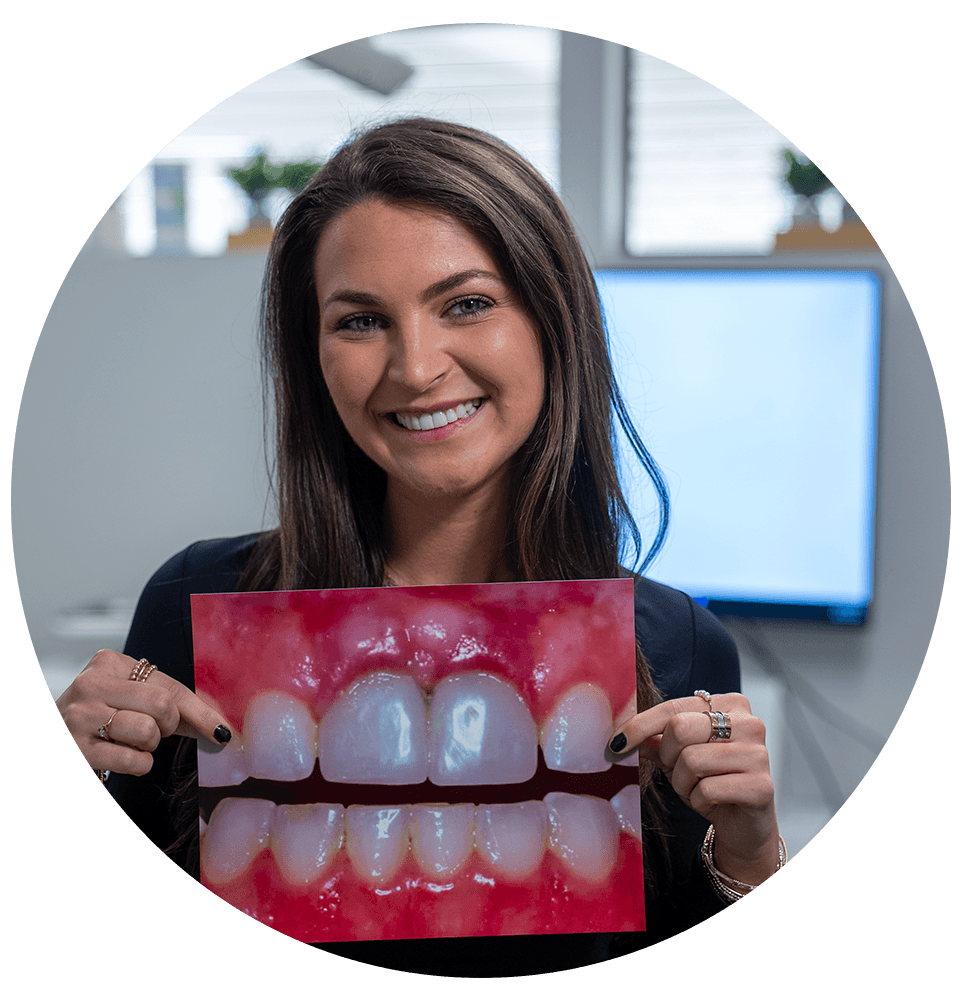 headshot of patient smiling with their before procedure image