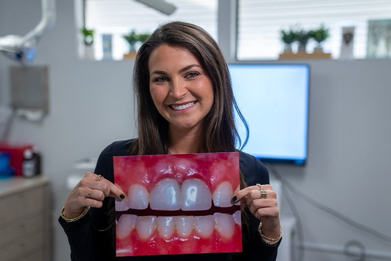 Makaelin crown lengthening patient testimonial